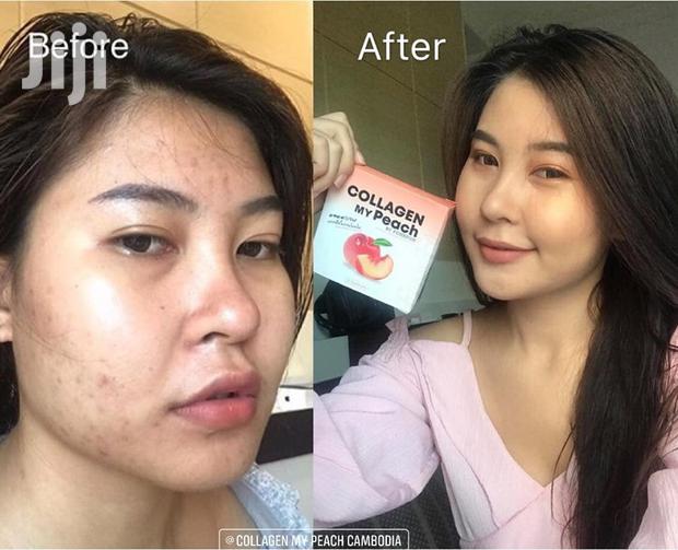 Collagen My Peach - thumbnail 4