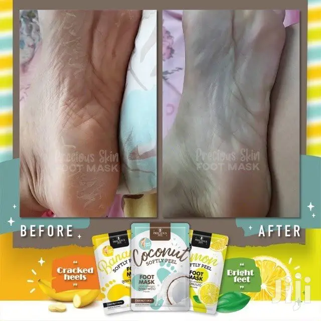 Softly Peel Foot Masks