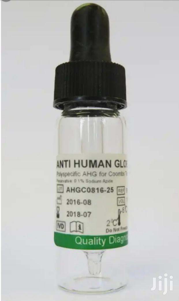 Ahg (Anti-human Globulin) - main view