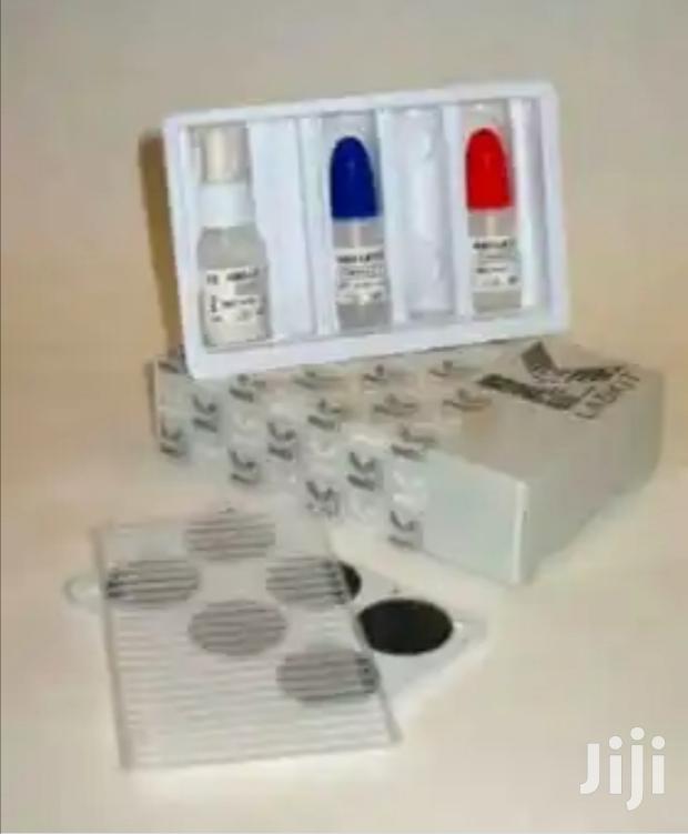 Hcg Reagents - main view