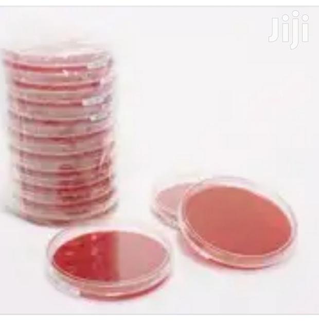 Blood Agar - main view
