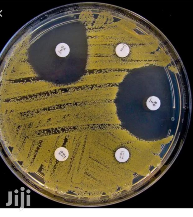 Sensitivity Discs 3/4 - main view