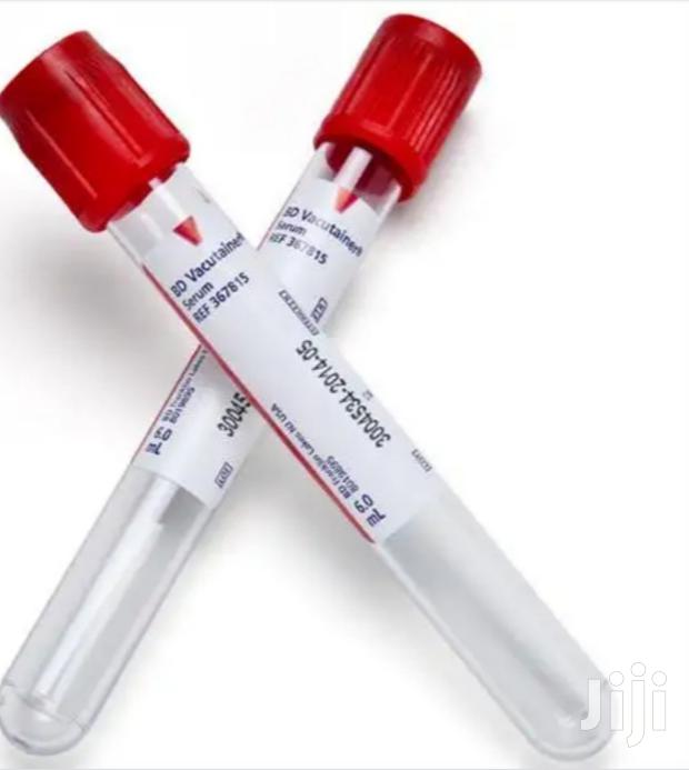 Red Top Tubes - main view