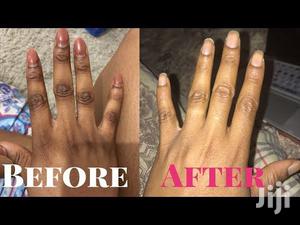 Chlonovate Whitening Cream