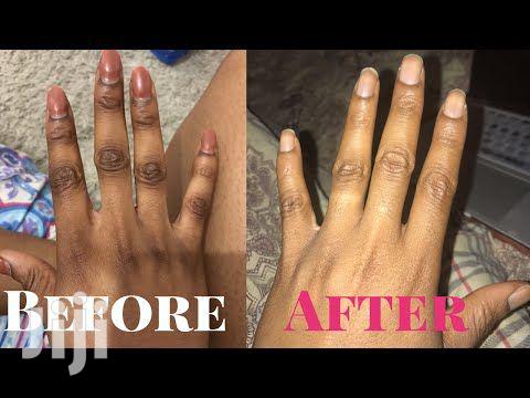 Chlonovate Whitening Cream - thumbnail 3