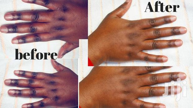 Chlonovate Whitening Cream - thumbnail 5