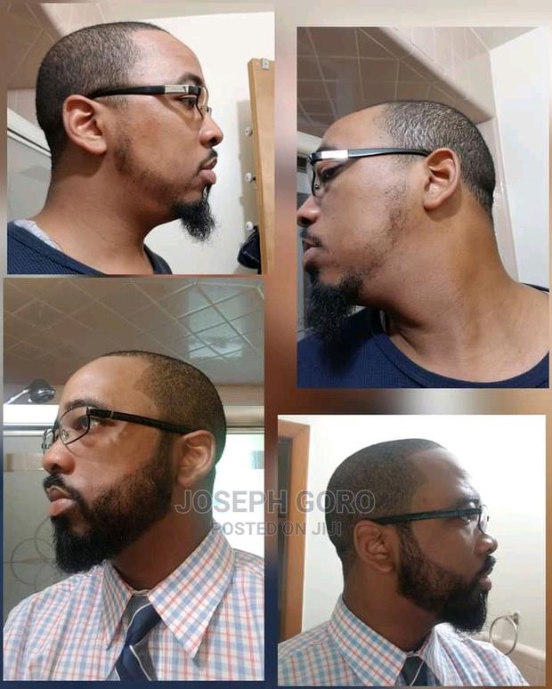 Minoxidil Original Israel - thumbnail 2