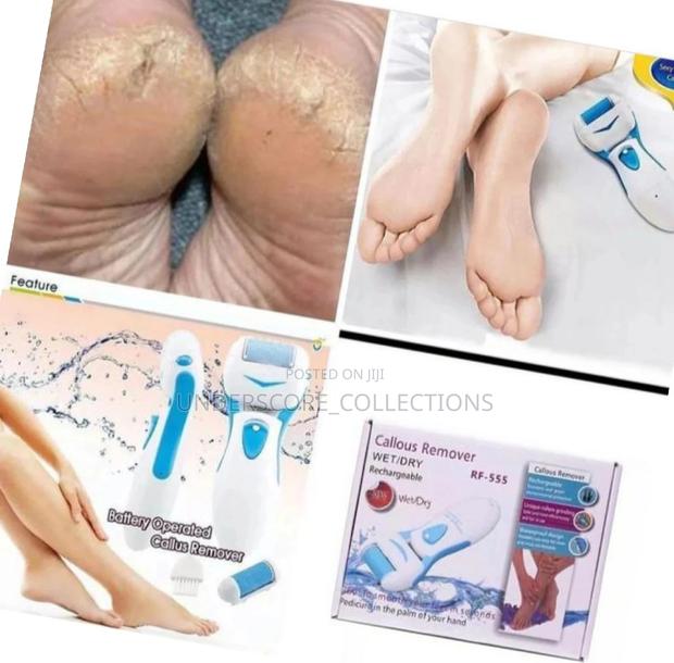 *Rechargeable Callous Remover* - main view