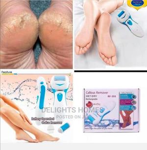 Rechargeable Callous Remover - thumbnail 2