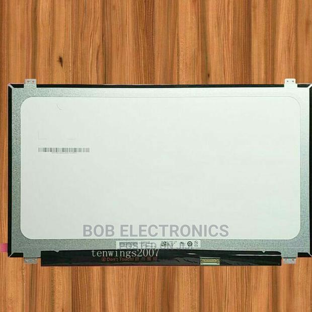 Hp 15.6 Laptop Screen Clearance