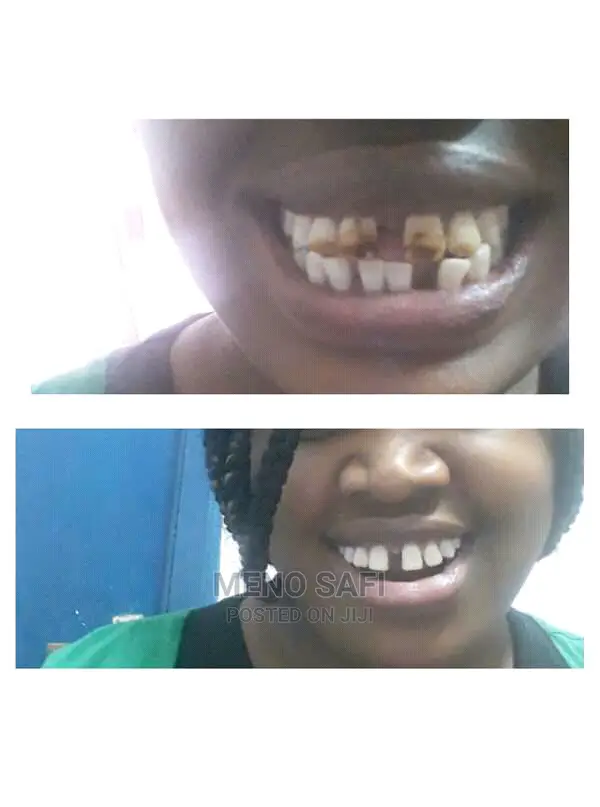 Dental Care And Issues