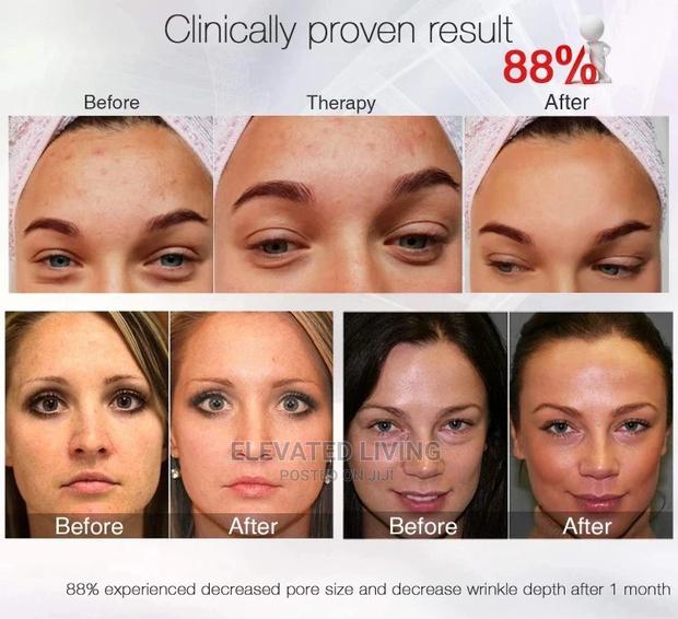 Say Goodbye to Acne and Wrinkles. - thumbnail 5