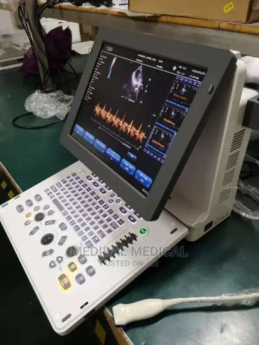 Eco Ultrasound Machine