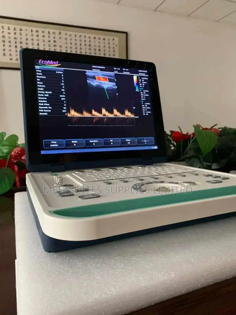 Colour Doppler Ultrasound Machine