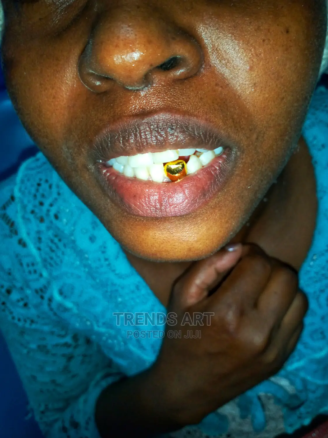 Pure Gold Teeth Available