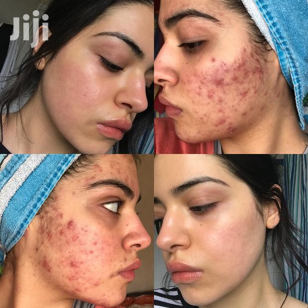 Raw Ghana Black Soap in Kenya - thumbnail 3