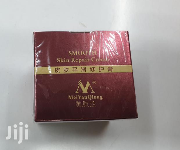 Sunburn Remover Cream - main view