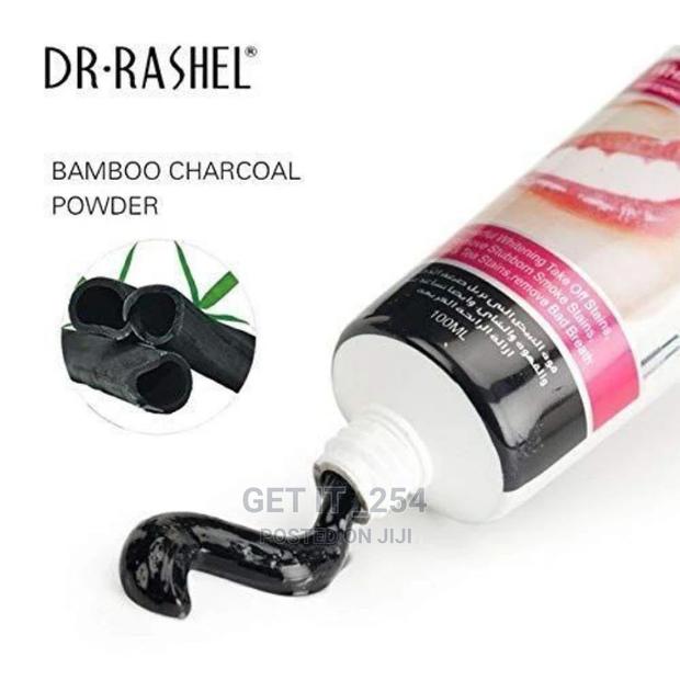 Teeth Whitening - thumbnail 2