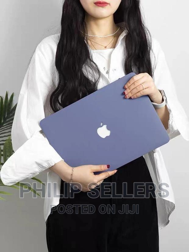 Does Your Macbook Need a Case - thumbnail 2