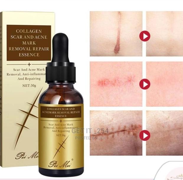 Scar and Dark Spots - main view