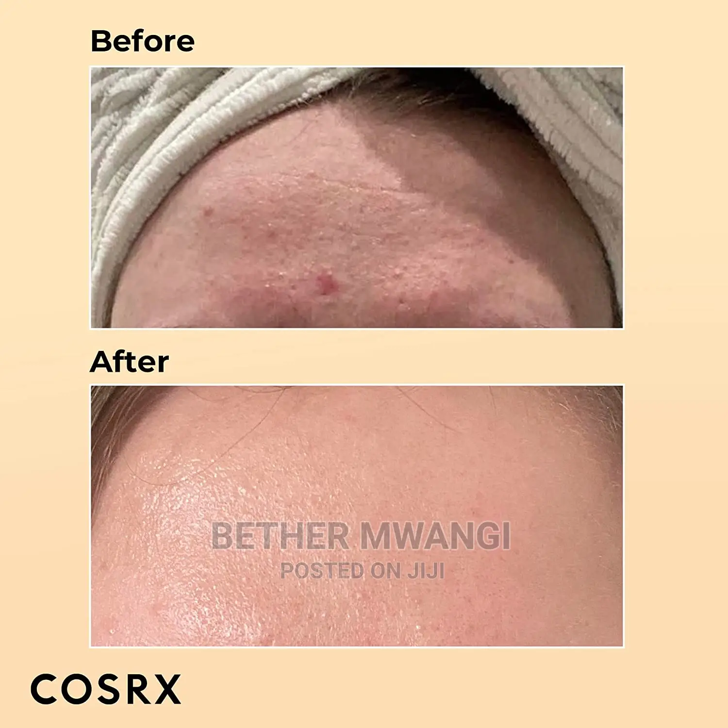 COSRX Advanced Snail96 Mucin Power Essence 100ml