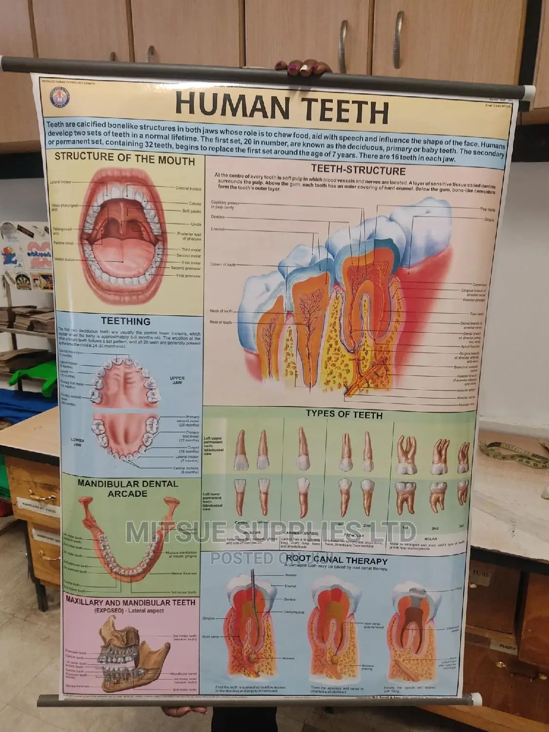 Chart of Detailed Human Teeth ( 43 by 28 Inch)