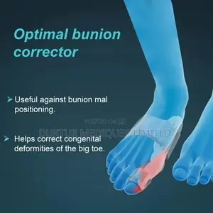Tynor Bunion Splint, White, 1 Unit