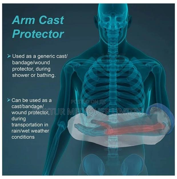 Tynor C-19 Cast Cover for Arm Universal - thumbnail 4
