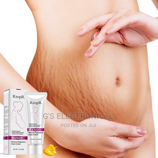 The Stretch Marks Cream - main view