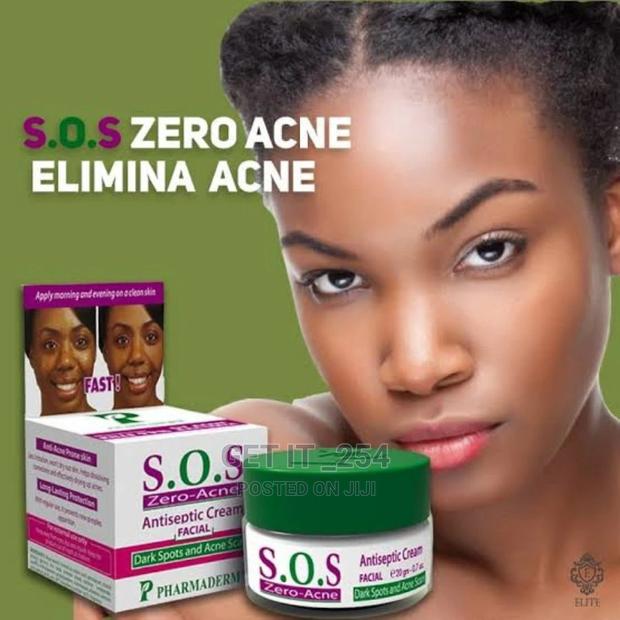 Sos Acne Removal Cream - main view