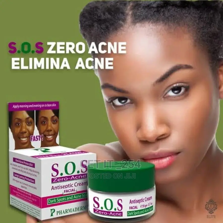 Sos Acne Removal Cream
