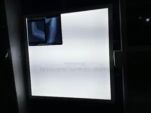 X-Ray Film Viewer