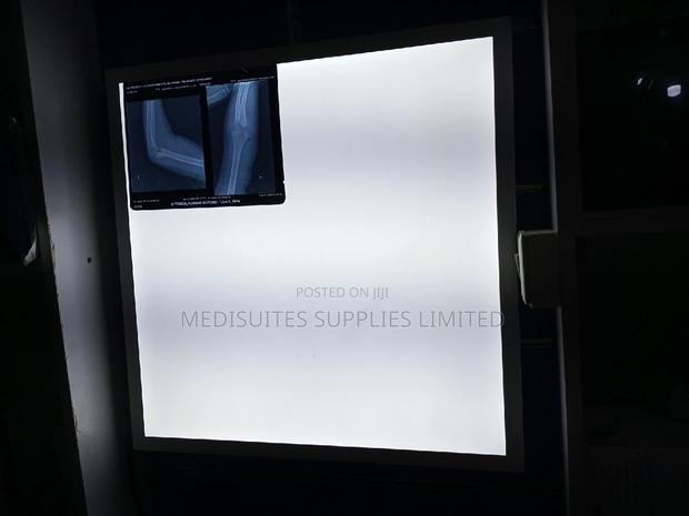 X-Ray Film Viewer - main view