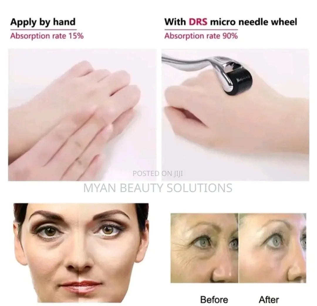 Professional Microneedling Skin Roller