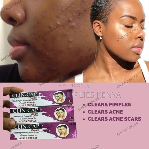 Clin Cap Pimple and Razor Bump Cream/ Anti Acne Cream.