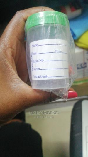 Stool and Urine Containers - thumbnail 2