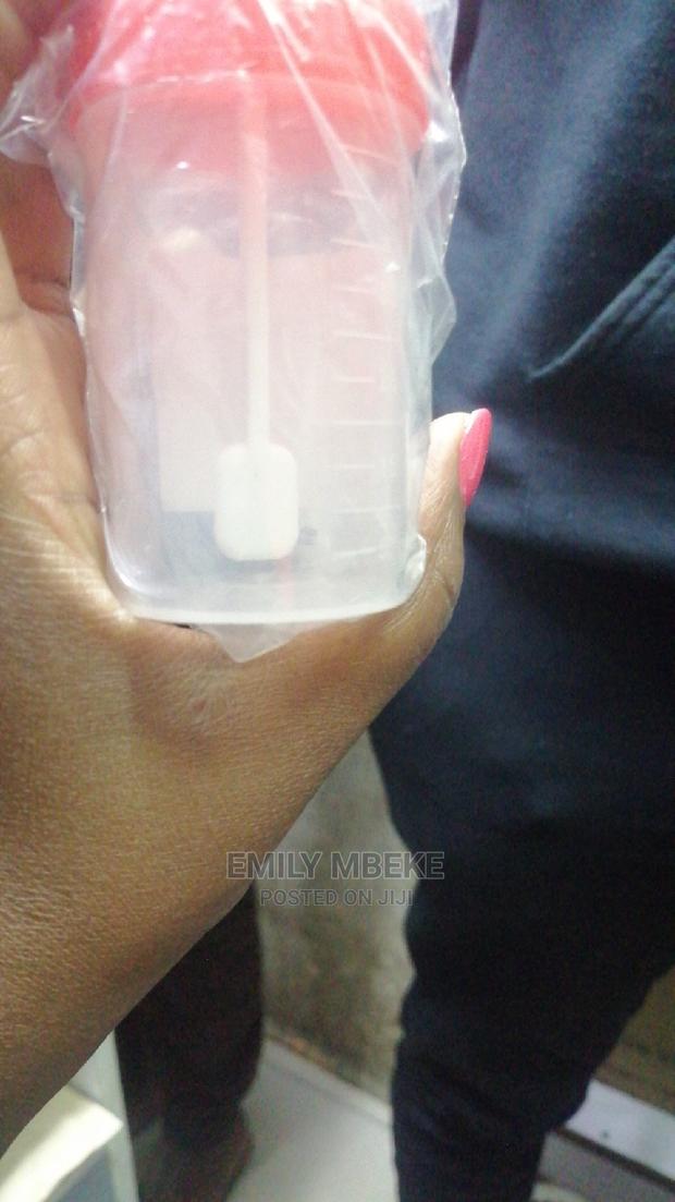 Stool and Urine Containers - thumbnail 3