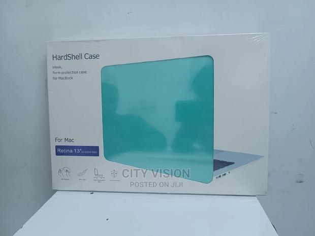 Macbook Laptop Casing for Macbook Protection - main view
