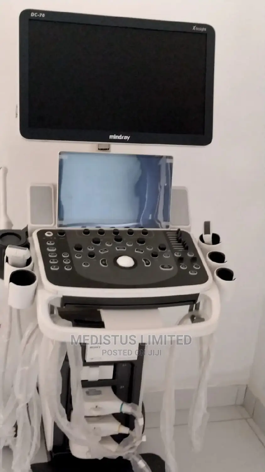 DC70 EXP Ultrasound Machine