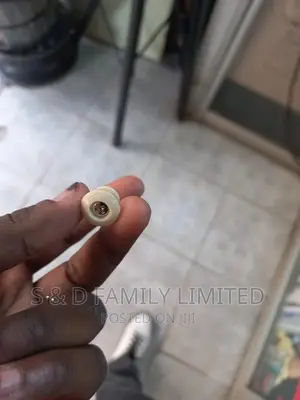 Plastic Guitar Strap Button