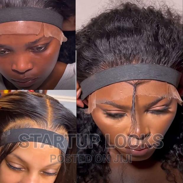 Lace Melting Band With Velcro - thumbnail 3