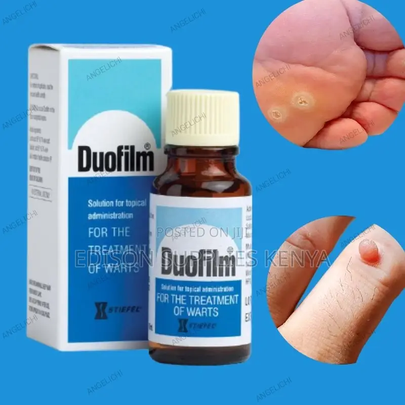 Duofilm Wart Remover Treatment Feet Corn Calluses Remover