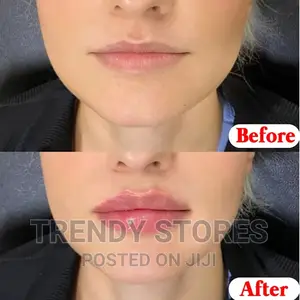 Moisturising Lip Balm