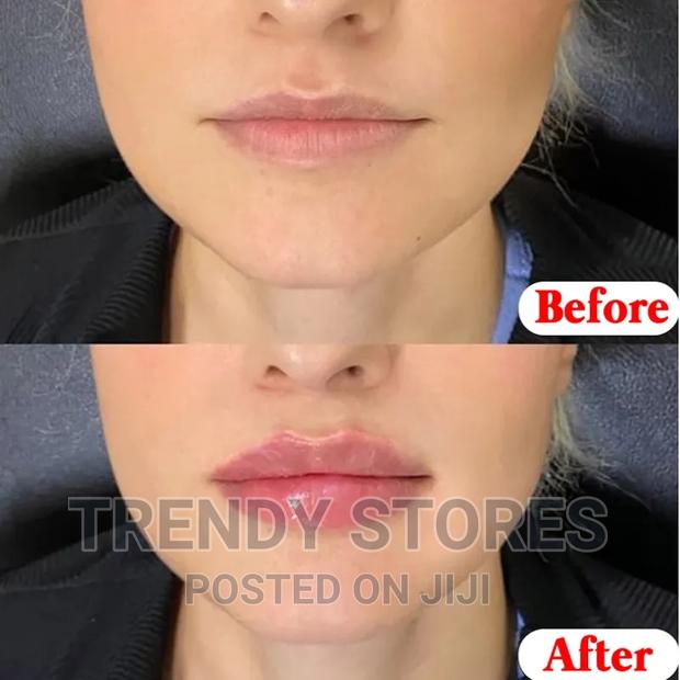 Moisturising Lip Balm - thumbnail 4