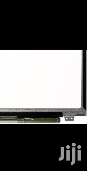 HP G3 Screen Replacement Services Available