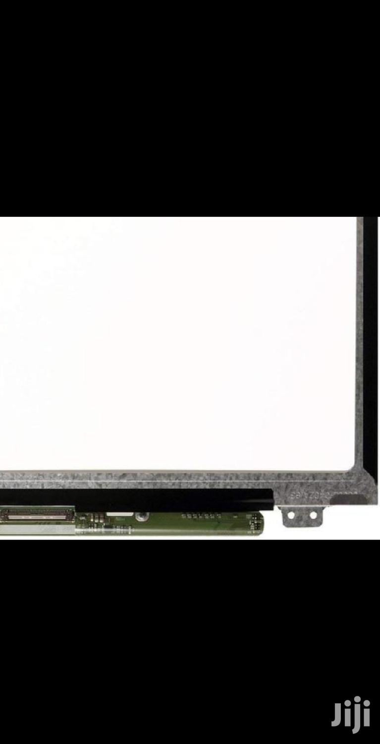 HP G3 Screen Replacement Services Available
