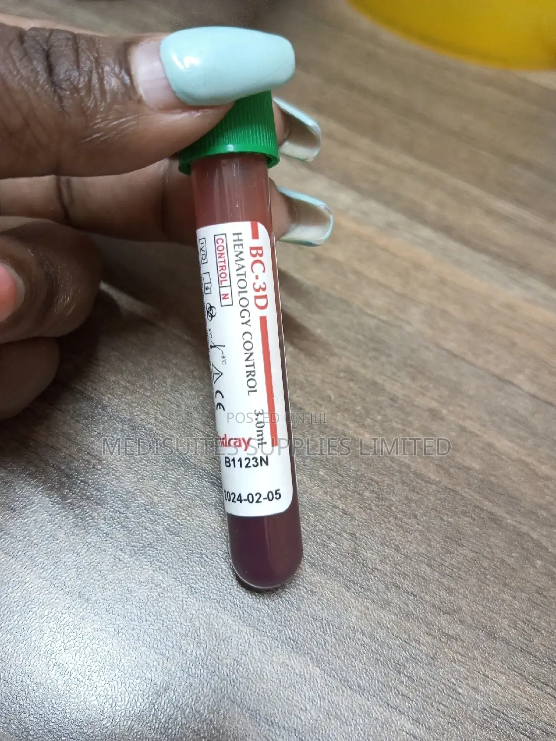 Hematology Control (, Normal)