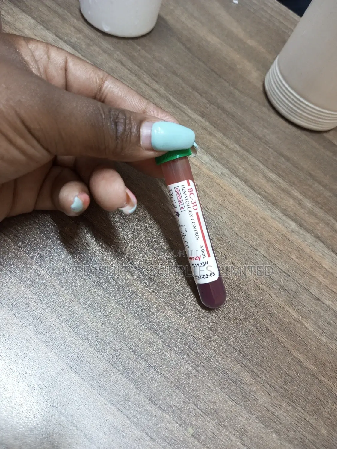 Hematology Control (, Normal)