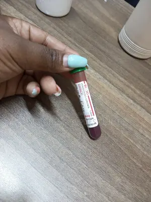 Hematology Control (, Normal)