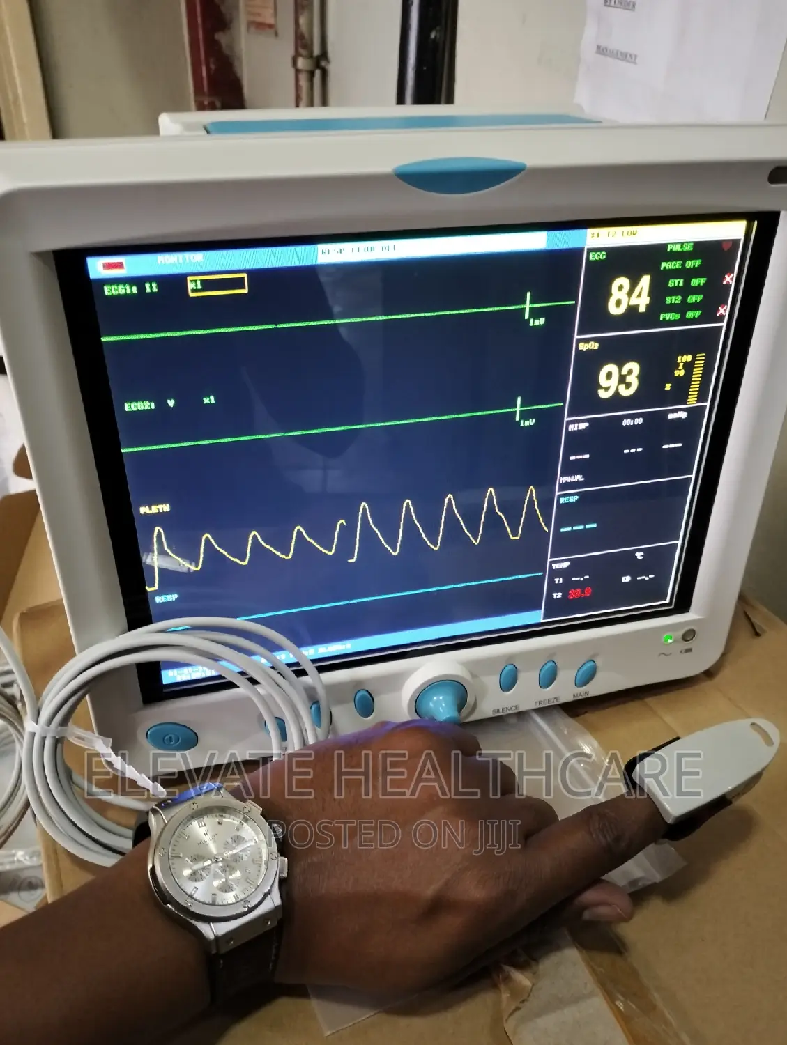 Patient Monitor